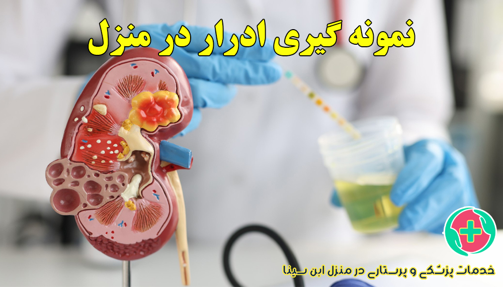 نمونه‌گیری ادرار در منزل مشهد | خدمات پزشکی و پرستاری ابن سینا