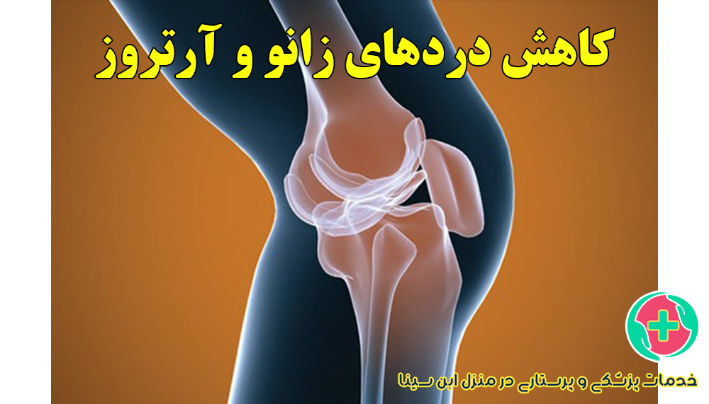 نقش فیزیوتراپی در کاهش دردهای زانو و آرتروز | مرکز پرستاری ابن سینا در مشهد