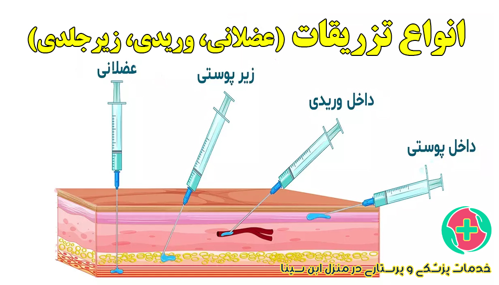 راهنمای جامع انواع تزریقات (عضلانی، وریدی، زیرجلدی) و کاربردهای آن‌ها