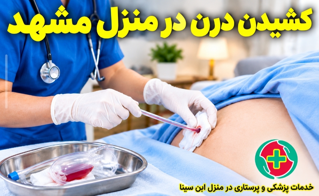 کشیدن درن در منزل مشهد | فوری و شبانه‌روزی