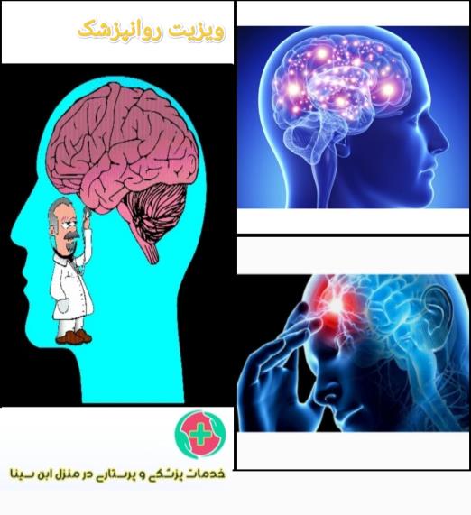 Igpqsq4D1l